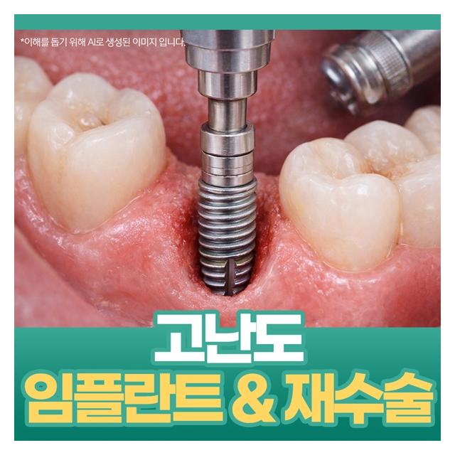 숙련된 노하우로 고난도 임플란트, 재수술까지